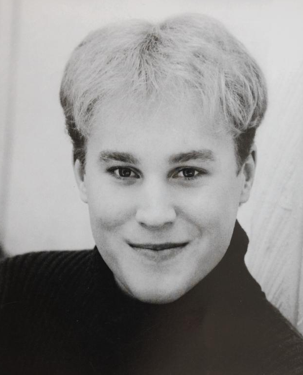Toby Sheldon at age 23 before having hair transplant and facial plastic surgery.png.png