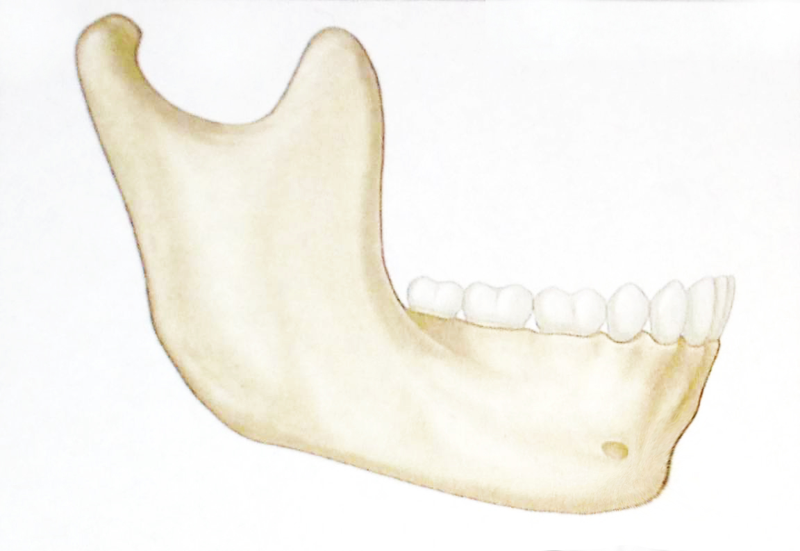 lateral-mandible-retrusive-chin-schematic.jpg