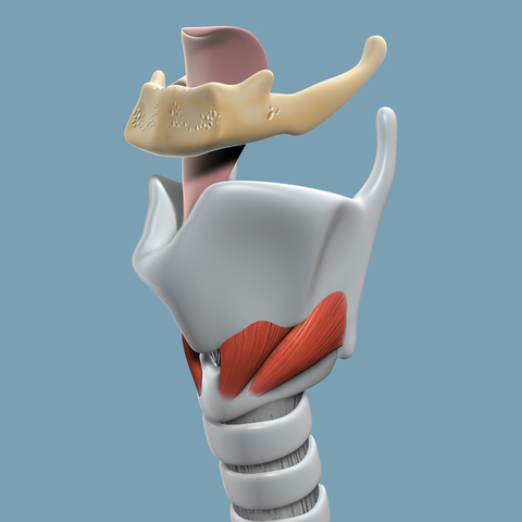 prominent-laryngeal-prominence-schematic.jpg